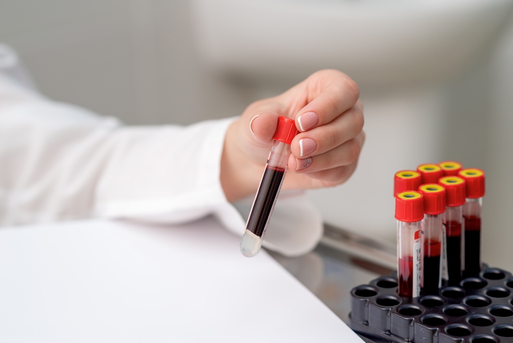 Clinic offers blood test that screens for more than 50 cancers