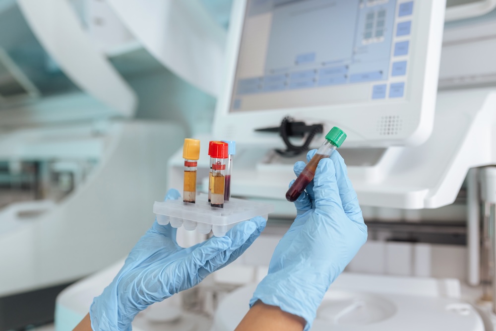 MHRA targets closer FDA ties to accelerate medtech innovation